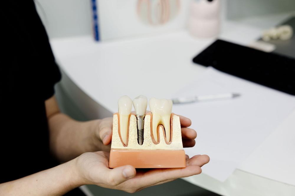 A person holds a tooth model, representing Root Canal Treatment at Northside Dental Solutions in Clayfield.