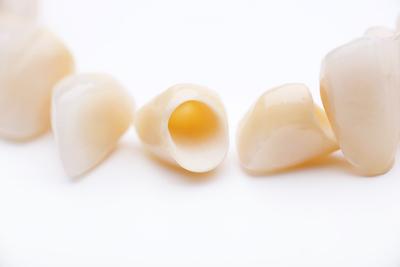 Various dental crowns and bridges arranged on a white background, showcasing options available in Clayfield